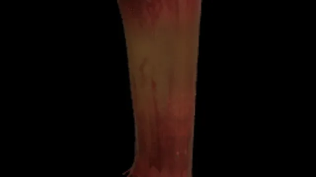 Right Leg Gib Cap