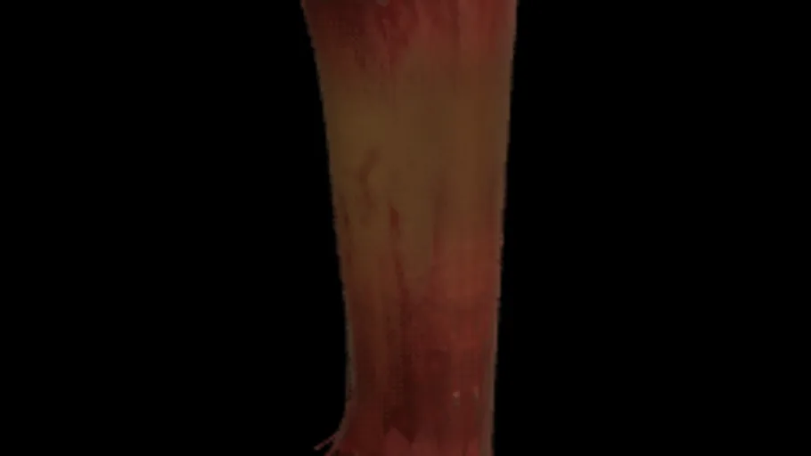 Right Leg Gib Cap