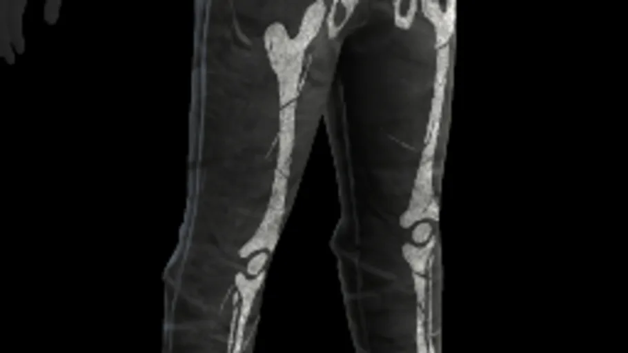 Skeleton Joggers