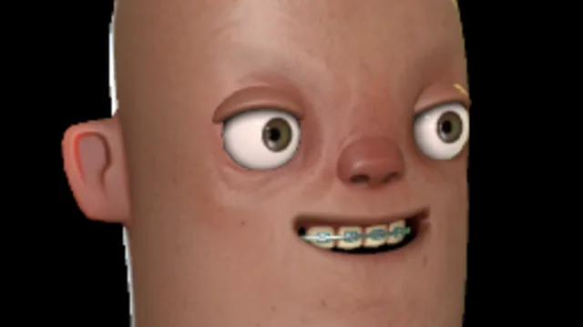 Braces