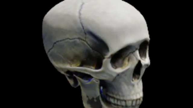 Skull