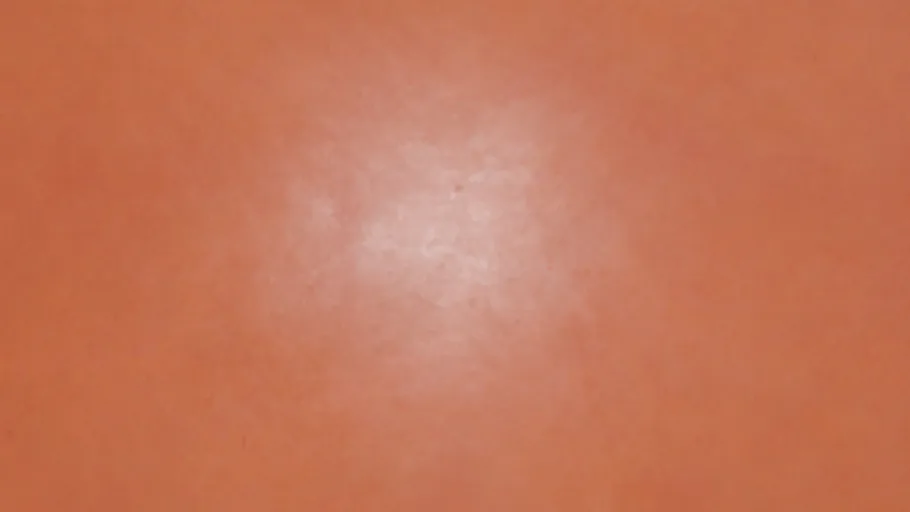 Orange Plaster